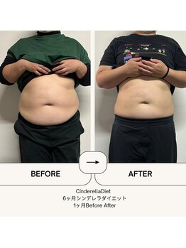 オーシャン整骨院(OCEAN整骨院)/６ヶ月ダイエットコース