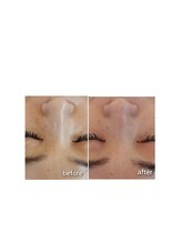 ケイリー(kaylee)/マグマハーブ