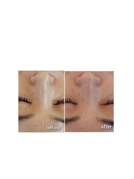 ケイリー(kaylee)/マグマハーブ