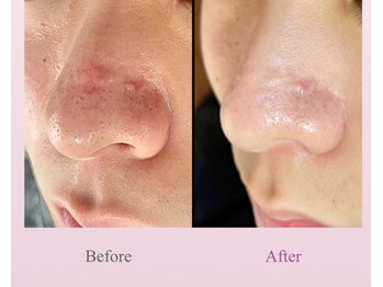 アディス 心斎橋(ADISE)/