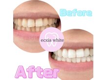 エクシアホワイト SOKA(ecxia white)/