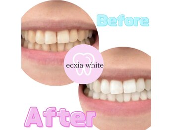 エクシアホワイト SOKA(ecxia white)/