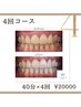【セット割◎】セルフホワイトニング4セット（1セット：20分×2）￥20000