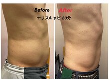 スーパースカルプ 大津店(SuperScalp)/ナリスキャビ20分