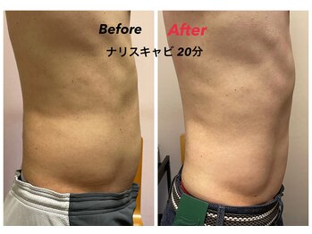 スーパースカルプ 大津店(SuperScalp)/ナリスキャビ20分