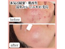 リアリア(LEALEA)の雰囲気（お肌内部から整えてシミへアプローチしていきます）