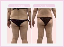 スリムライン 仙台店(The Slim Line)/before→after