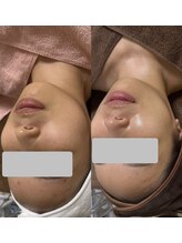 ソルティ サロン(salty salon)/ララピール