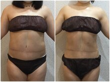 美容整体ウェリナ 名駅院/小顔矯正/骨盤矯正/美脚サロン