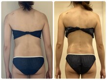 プリンセス ボディ/筋膜×強圧リンパマッサージ