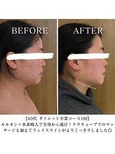 ヨサパーク サンテ 祐天寺(YOSA PARK sante)/痩身/ダイエット/よもぎ蒸し痩身