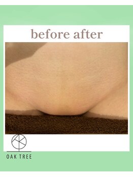 オークツリー(oak tree)/Before After