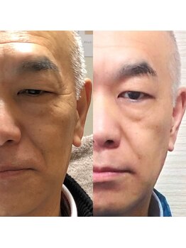 アキ/初回お試し2日後の変化