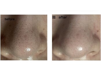 スカイアンドシー(sky&sea)の写真/「毛穴を隠すメイク」はもう卒業。最短で手に入れる滑らかな素肌感。結果重視、敏感肌で諦めてた方も大歓迎