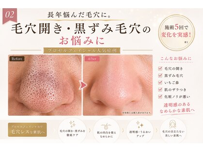 チル(Chill)の写真