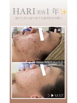 ルルボーテ(Loulou Beaute)/waxxxx+VOSサロンケア