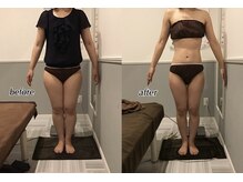 プレミアム ボディ ケア(Premium Body Care)/Before After 【30代】