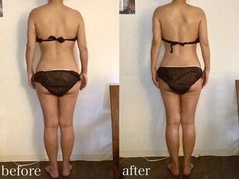 メリア 翠町店(Melia)/姿勢も整い背中美人に♪