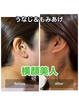 カロス(Calos)/うなじ＆もみあげセット