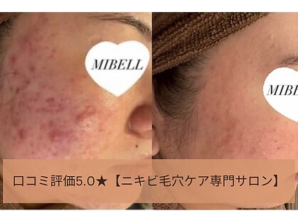ミベル フェイシャルサロン(MIBELL FACIAL SALON)の写真