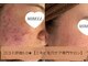 ミベル フェイシャルサロン(MIBELL FACIAL SALON)の写真