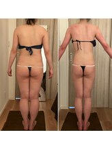 レジュベール(Rejuvel)/ブライダルエステ♪