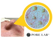 ポア ラボ(Pore Lab)
