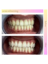 エクシアホワイト 倉吉店(ecxia white)/ビフォーアフター
