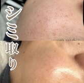 リサロン エヌ(Re salon N)