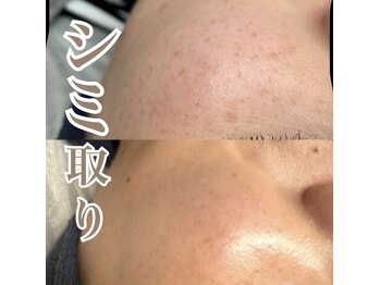 リサロン エヌ(Re salon N)