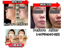 コンフィデンス 谷町四丁目店(Confidence)