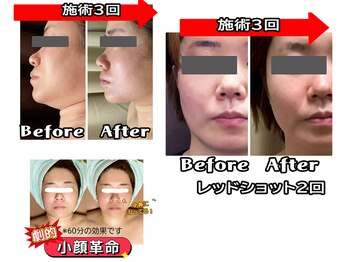 コンフィデンス 谷町四丁目店(Confidence)