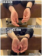 リズベット(LIZ BET)/産後ケアに！フェムケア矯正