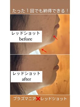 エステルーム クリスタル/『レッドショット』の凄さ！