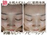 《水光肌》肌質改善ハーブピーリング+イオン導入☆跡を残さずニキビケア