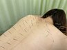 【初めての方向け！】効果をすぐ実感できる鍼施術　２部位まで　2500円