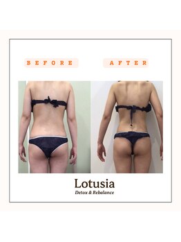 ルトゥーシア(Lotusia)/上半身　before→after