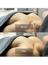 サロン リヒカ(Salon Rihica)/下垂削げ胸のお悩みにも