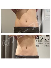 フローフシ∞/【集中痩せ】4ヶ月で-10.5cm