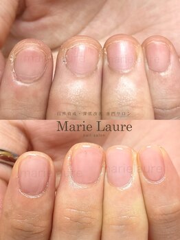マリーロール 淀屋橋本店(Marie Laure)/自爪育成/深爪矯正/ネイルケア