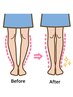 【人気NO.1美脚O脚矯正】お得な３回セット