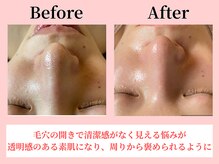 ココロ(COCORO)/美脳小顔矯正＆毛穴洗浄