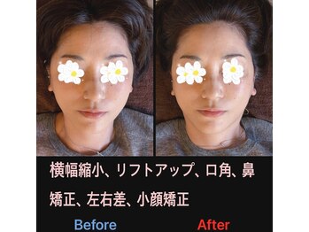 美容矯正サロン レレポノ(LELEPONO)/