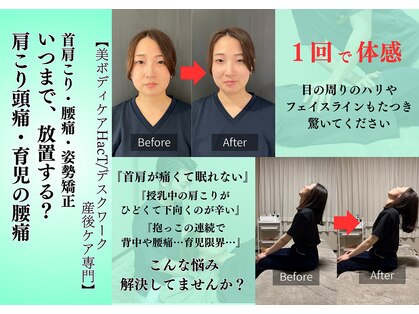 ハクト(HacT)の写真