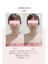 トゥインクル 麻布(twinkle)/南麻布/シンメトリー小顔矯正