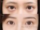 アイロンボーイ(IRONBOY)の写真