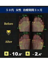サラ(SARA)/