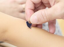 れんげ鍼灸整骨院/【京橋】お子様の施術にも♪