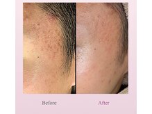 アディス 心斎橋(ADISE)/