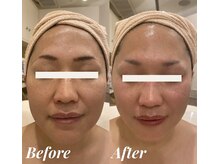 シェリール(Cherir)の雰囲気(肌質改善×小顔どちらも叶えます☆)